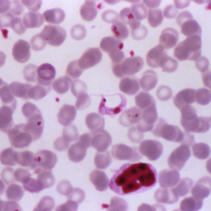 Centers for Disease Control and Prevention image: Under a magnification of 1000X, this is a micrograph revealing Trypanosoma cruzi parasites in a blood smear using Giemsa staining technique. This  parasite is the causative agent for Chagas disease.
