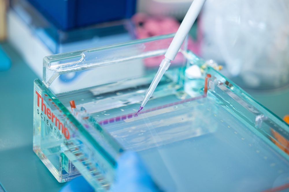 A pipette deposits a purple sample into a clear chamber labeled Thermo Scientific, used for molecular biology research in the Truman Lab.